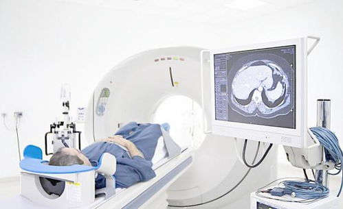 第一類醫(yī)療器械經(jīng)營 無需備案，但需合規(guī)